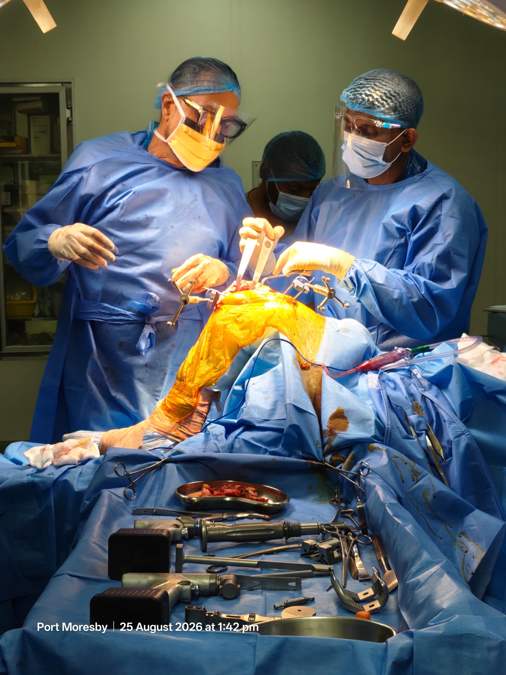 Robotic Knee Replacment Townsville, Knee Replacement Townsville