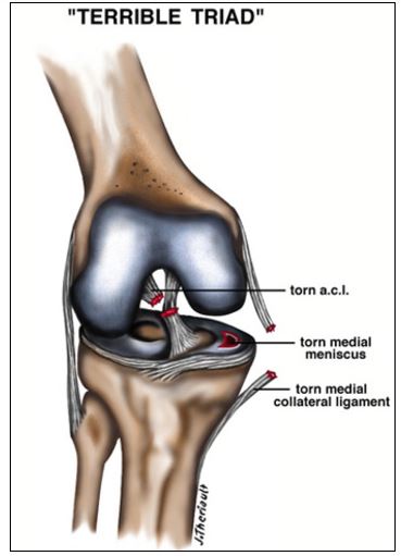 knee surgeon townsville dr kaushik hazratwala