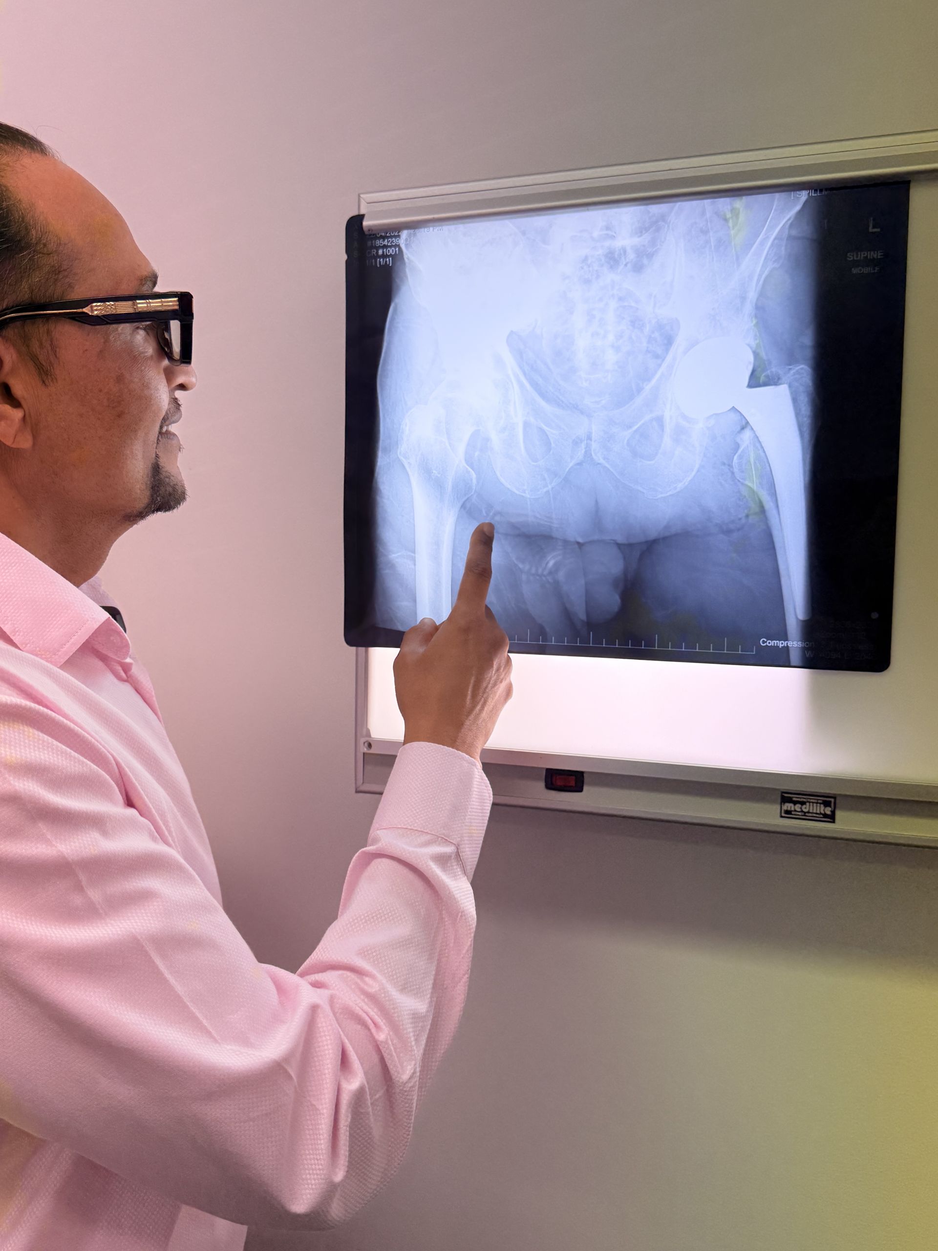 A/Prf Kaushik Hazratwala, Hip and Knee Surgeon , Hip Replacement