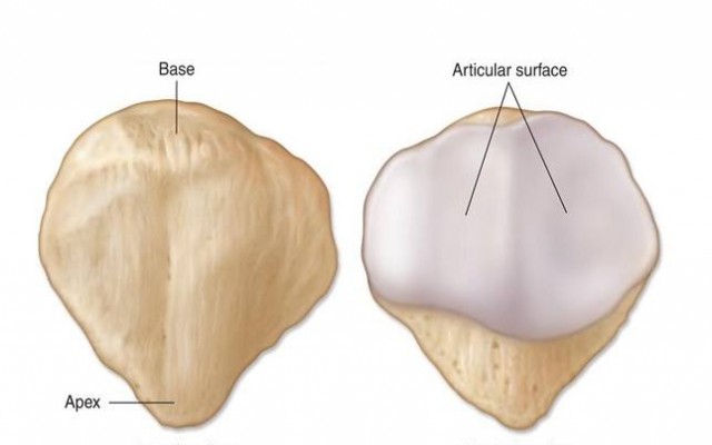 Who is more likely to have anterior patella pain (knee cap)?