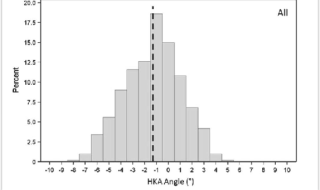 Computer Navigation is for the Outliers!!!!!!